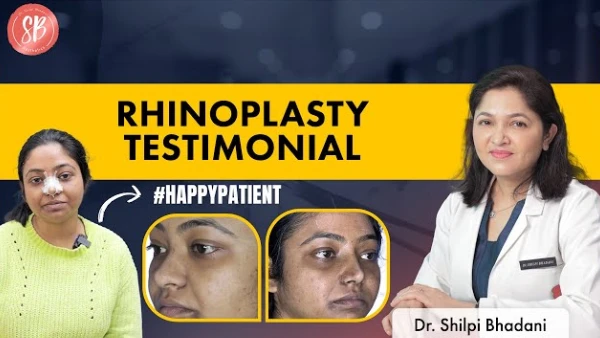 An International patient's experience of Liposuction - SB Aesthetics
