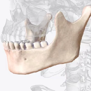 Orthognathic Surgery