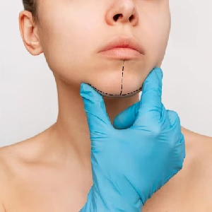 V-Line Jaw Surgery
