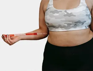 Tummy Tuck