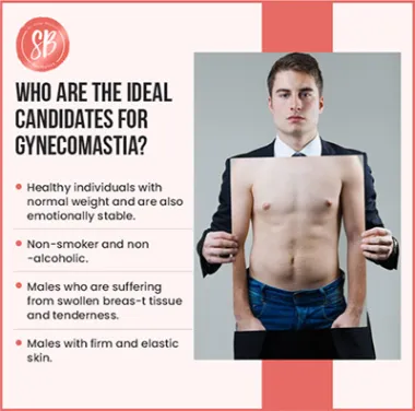 Ideal candidates for gynecomastia surgery