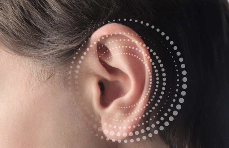 Ear Pin Back Surgery - Solution to Your Prominent Ear
