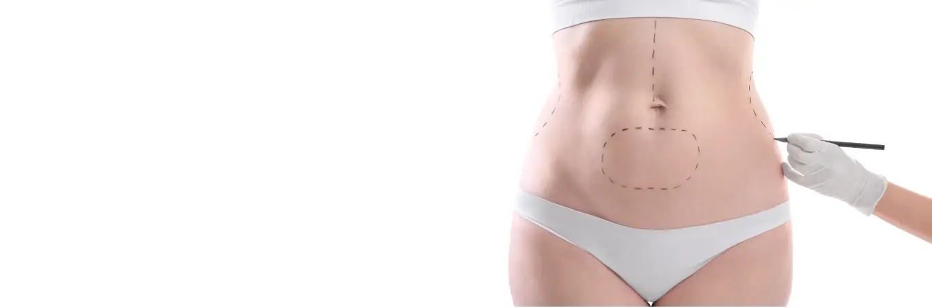 Liposuction Surgery in India