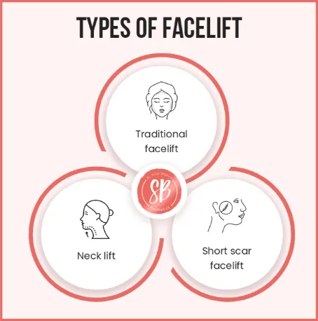 Types of facelift surgery 