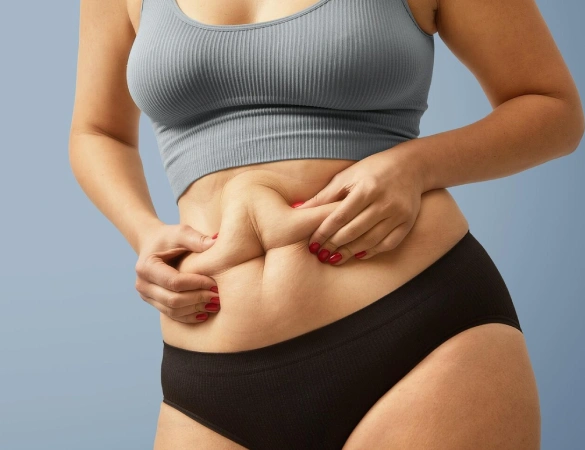 Tummy Tuck Surgery in Dhanbad