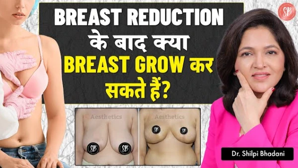 क्या Breast Reduction Surgery के बाद Breast बढ़ सकते हैं? | Plastic Surgeon ने बताया | SB Aesthetics