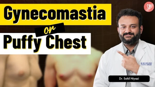 Gynecomastia symptoms & treatment | Gynecomastia Surgery Cost in Delhi NCR, Gurugram | SB Aesthetics