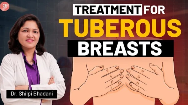 What Are Tuberous Breasts? Causes, Grading & Treatments Explained by Dr. Shilpi Bhadani