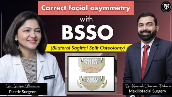 Correction of Misaligned Jaw & Facial Asymmetry | Bilateral Sagittal Split Osteotomy (BSSO) Surgery