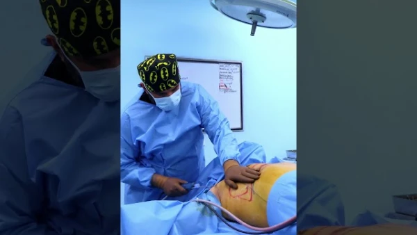 Redefining Confidence with Gynecomastia Surgery #gynecomastiasurgery