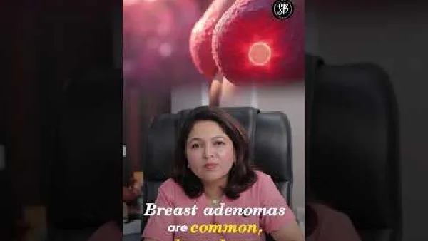 Breast Fibroadenoma: Symptoms, Treatment & Cancer Risk #fibroadenoma