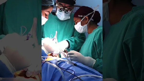 Genioplasty Changed His Jawline Completely #plasticsurgery #cosmetic #transformation